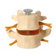 vertebras-lombares-anatomic-02-pecas.centermedical.com.br