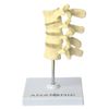 osteoporose-4-vertebras..centermedical.com.br